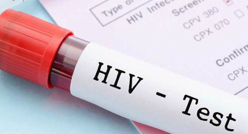 Adolescentes gays representam 92% dos casos de HIV no seu grupo etário